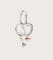 فاعلية العضلات ونغمتها لزيادة فعاليتها